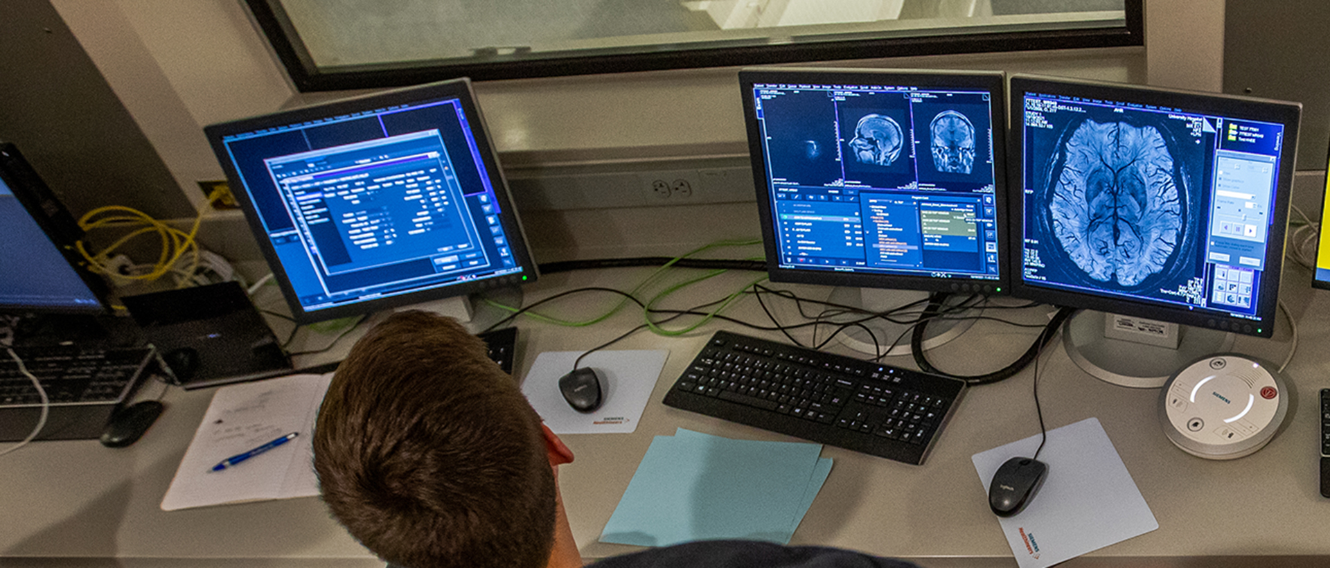 computers displaying MRI images of the brain